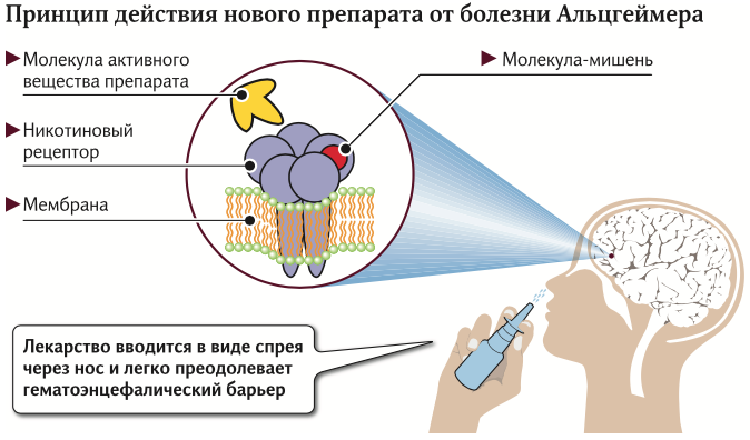 Альцгеймер